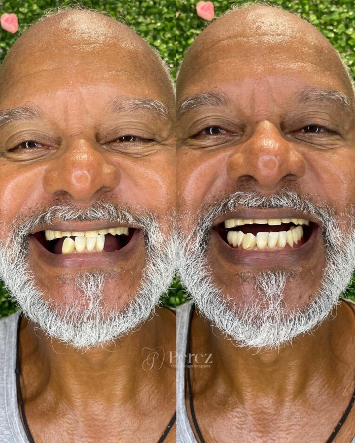 antes e depois novo 5