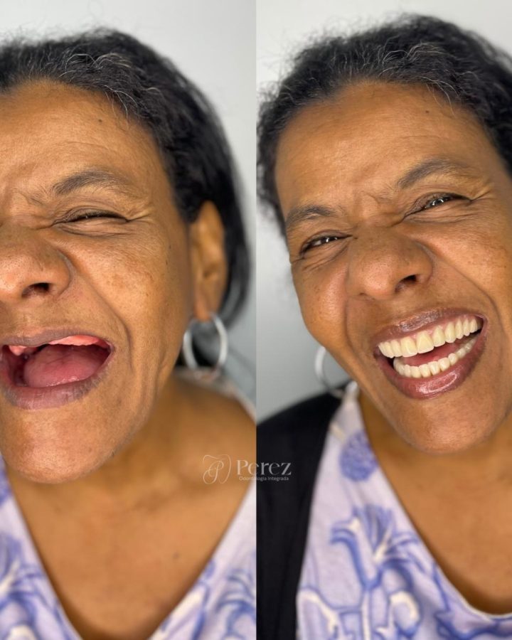 antes e depois novo 8